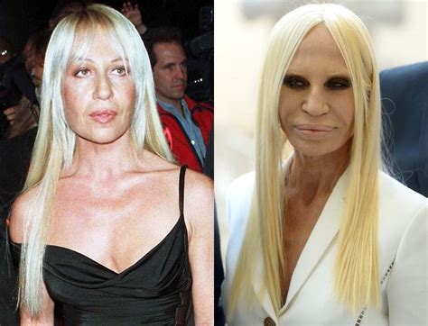 donatella versace wikipedia fr|donatella versace before and after surgery.